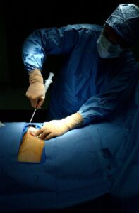surgery, operation, hospital, patient, doctor, physician, medicine, medical, surgical, light, georgetown university hospital, bone marrow harvest, blue hospital, blue medical, blue doctors, blue medicine, surgery, surgery, surgery, surgery, surgery